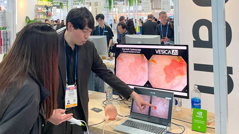 CES2026(2026年1月、米国ラスベガス) のJapanパビリオンでは膀胱内視鏡検査支援システムのデモを実施した。